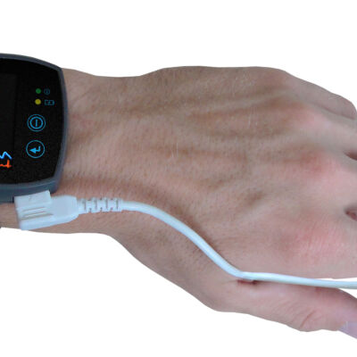 SOT NIBP_Arm_mit neuen Zahlenwerten_mitEKG